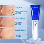 Lion Pair Acne Care 14g